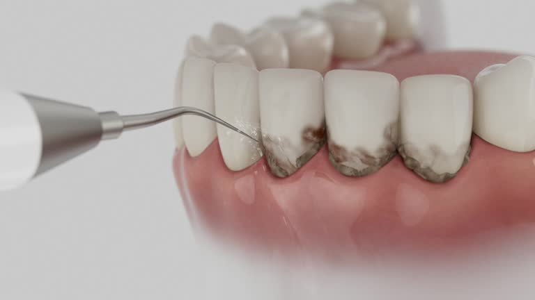 Reliable Dental contractor in Bismarck, MO by Smile Center Dentistry